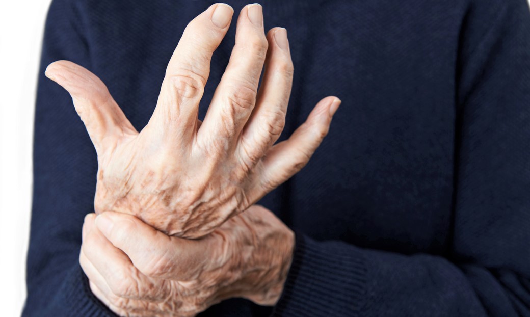 Revmatoidní artritidou trpí v Česku sto tisíc lidí, nejvíce ženy