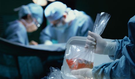 V Česku roste počet
zemřelých dárců organů
 