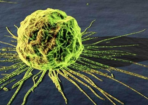 Čeští vědci objevili  šetrnou
metodu léčby rakoviny